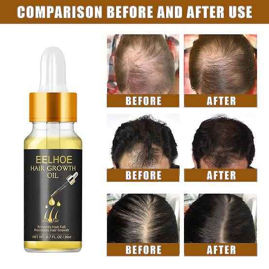 EELHOE Hair Growth Serum for Men Women - BD Drop