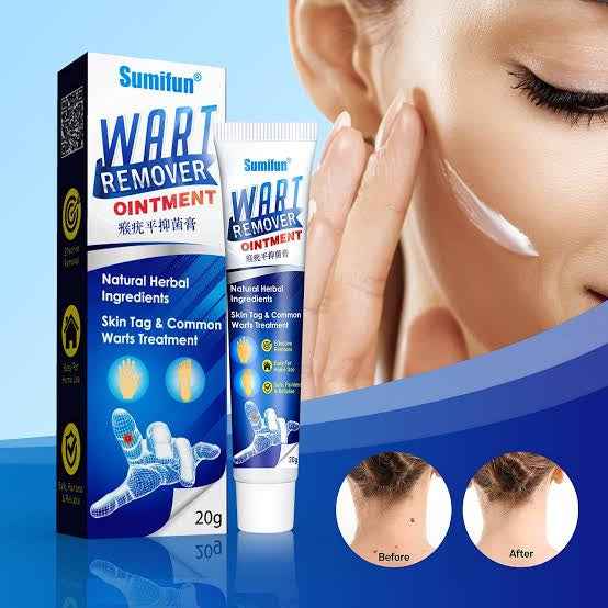 Wart Remover Ointment 20gm - BD Drop